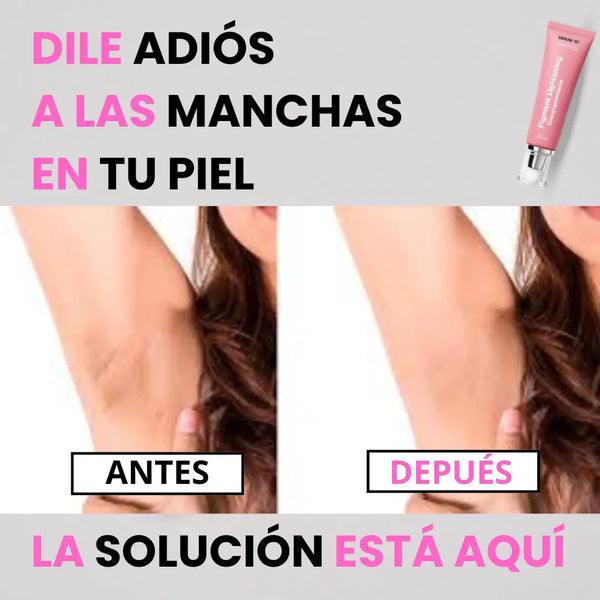 Suero Iluminador de Piel